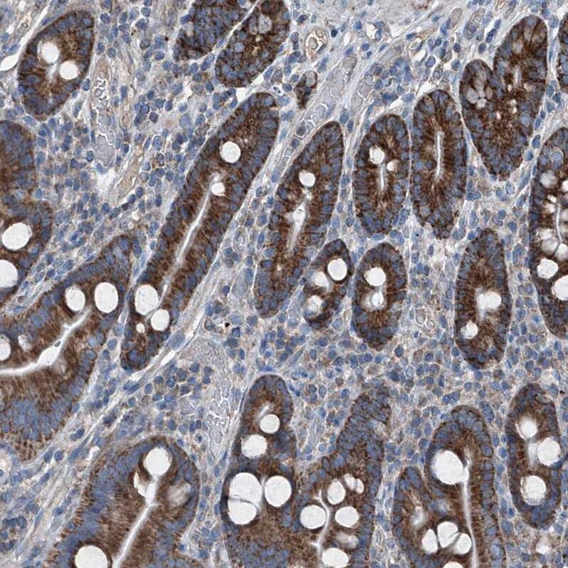 AGPAT9 Antibody - BSA Free Immunohistochemistry: AGPAT9 Antibody - BSA Free [NBP1-93692]