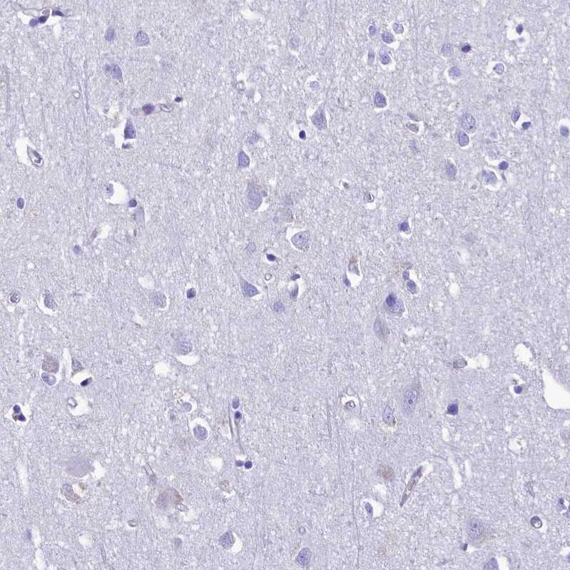 TTC36 Antibody - BSA Free Immunohistochemistry: TTC36 Antibody - BSA Free [NBP1-93702]
