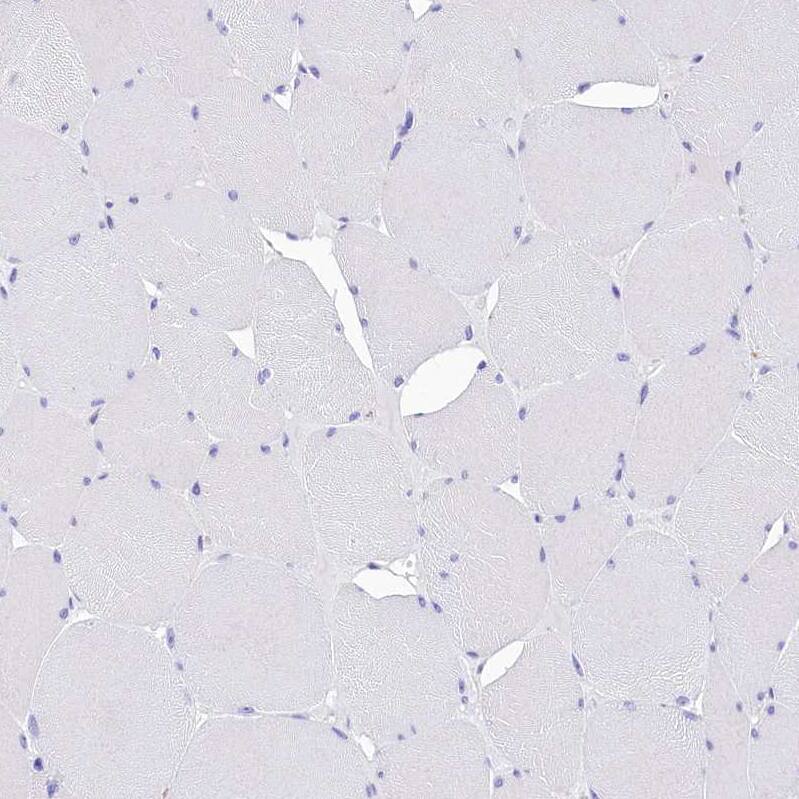 TTC36 Antibody - BSA Free Immunohistochemistry: TTC36 Antibody - BSA Free [NBP1-93702]
