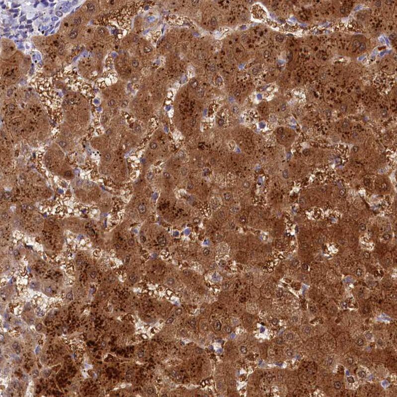 TTC36 Antibody - BSA Free Immunohistochemistry: TTC36 Antibody - BSA Free [NBP1-93702]
