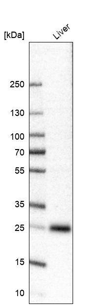 TTC36 Antibody - BSA Free Western Blot: TTC36 Antibody - BSA Free [NBP1-93702]