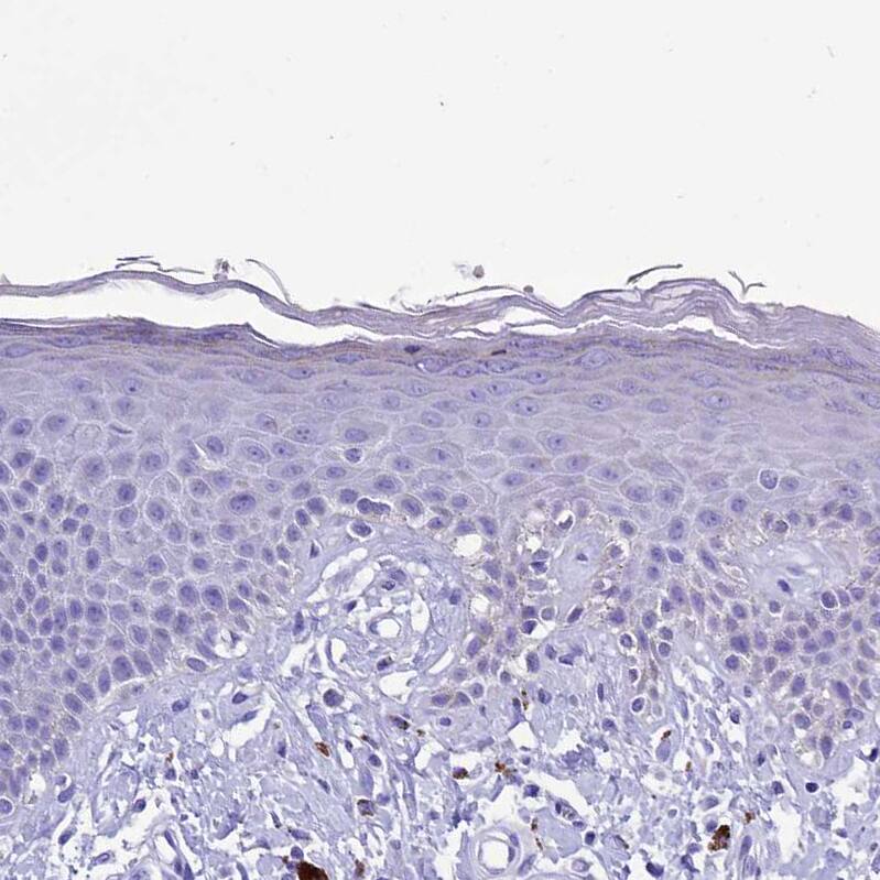TTC36 Antibody - BSA Free Immunohistochemistry: TTC36 Antibody - BSA Free [NBP1-93702]