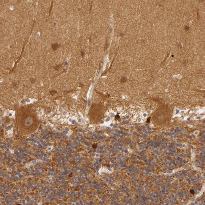 PPP1R3F Antibody - BSA Free Immunohistochemistry: PPP1R3F Antibody - BSA Free [NBP1-93703]