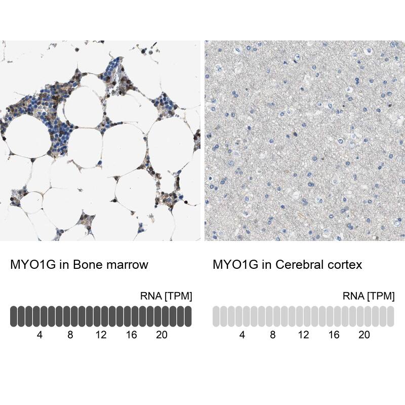 MYO1G Antibody - BSA Free Immunohistochemistry: MYO1G Antibody - BSA Free [NBP1-93704]