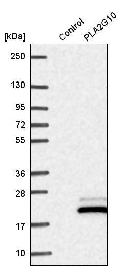 PLA2G10 Antibody - BSA Free Western Blot: PLA2G10 Antibody - BSA Free [NBP1-93706]
