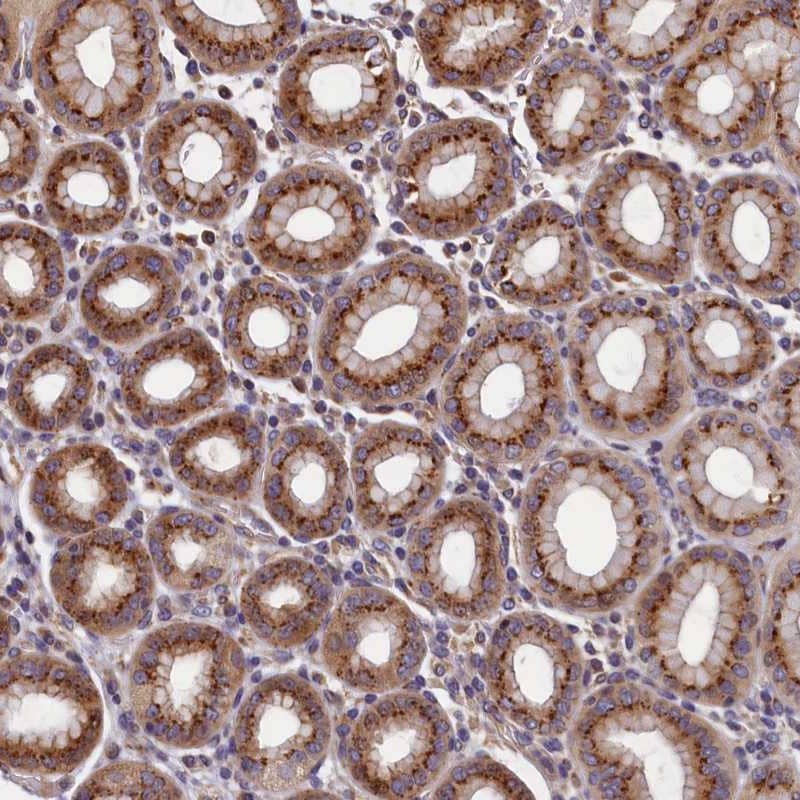 TMEM181 Antibody - BSA Free Immunohistochemistry-Paraffin: TMEM181 Antibody [NBP1-93711]