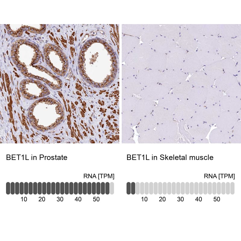BET1L Antibody - BSA Free Immunohistochemistry: BET1L Antibody - BSA Free [NBP1-93714]
