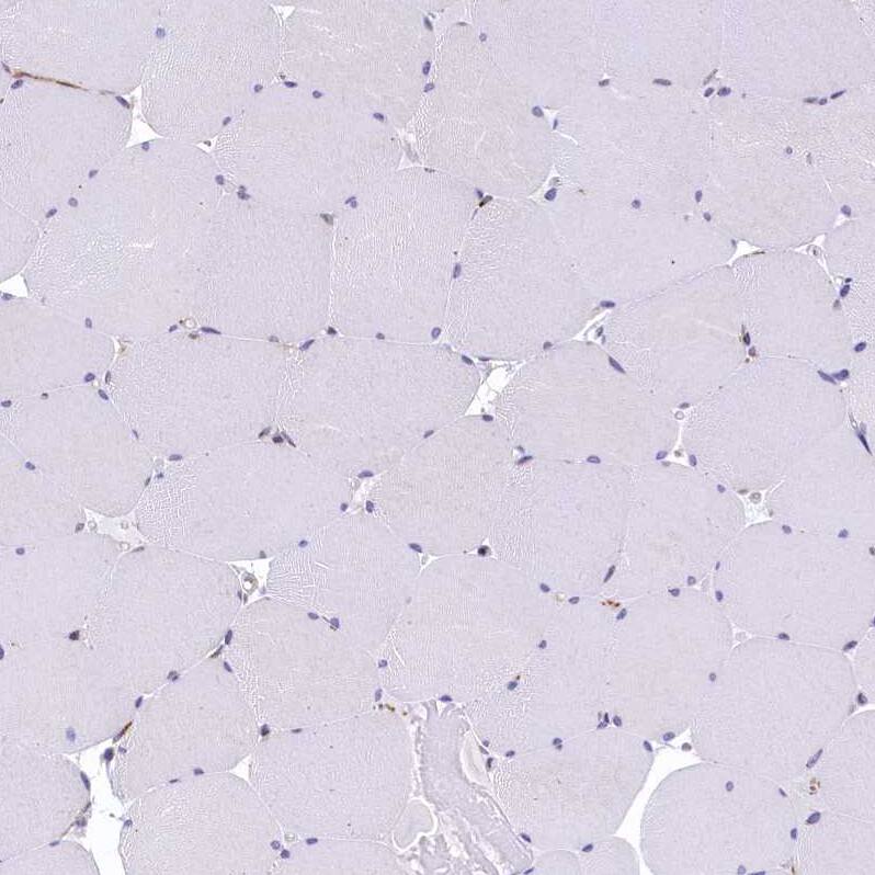 BET1L Antibody - BSA Free Immunohistochemistry: BET1L Antibody - BSA Free [NBP1-93714]