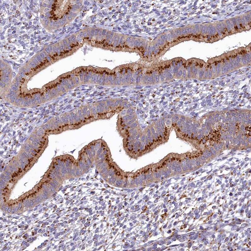 BET1L Antibody - BSA Free Immunohistochemistry: BET1L Antibody - BSA Free [NBP1-93714]