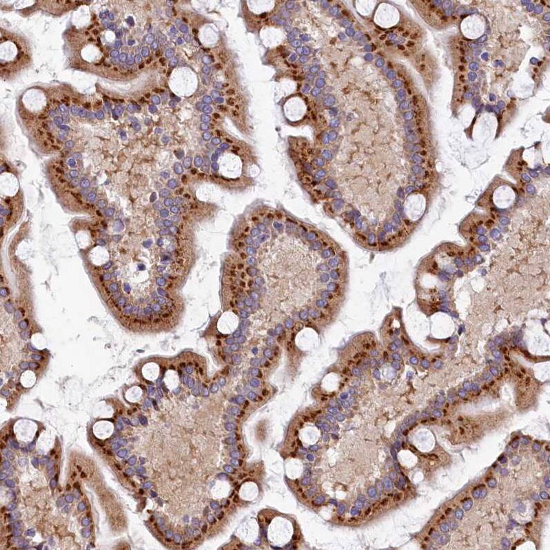 BET1L Antibody - BSA Free Immunohistochemistry: BET1L Antibody - BSA Free [NBP1-93714]