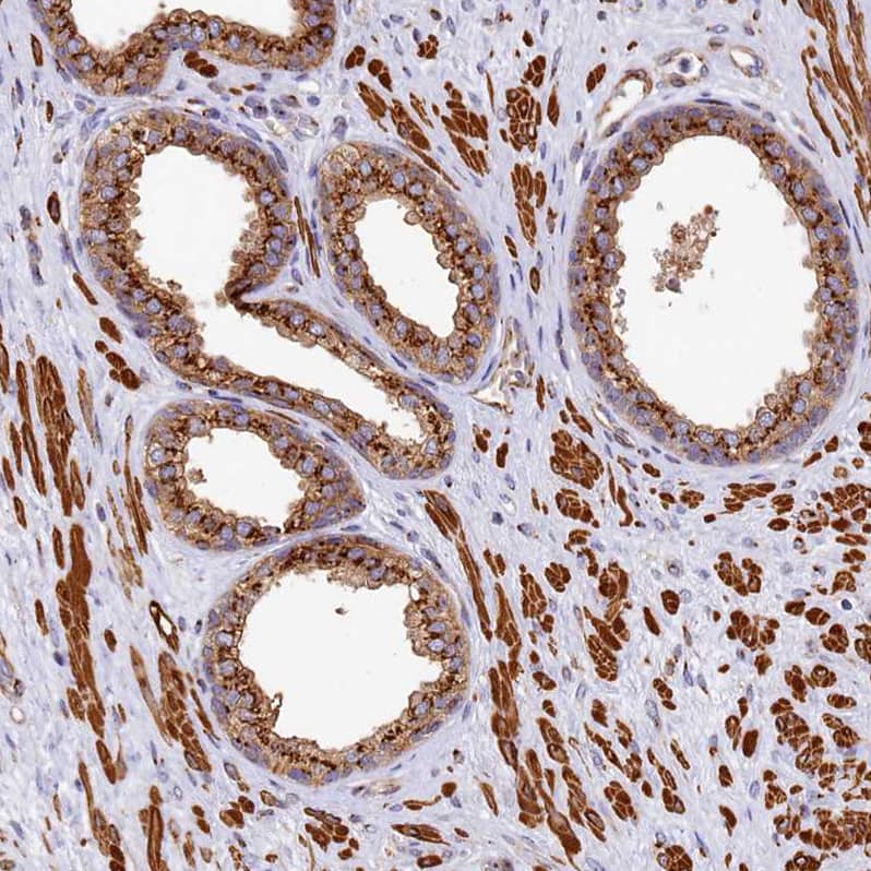 BET1L Antibody - BSA Free Immunohistochemistry: BET1L Antibody - BSA Free [NBP1-93714]