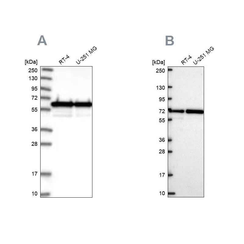 CCDC47 Antibody - BSA Free Western Blot: CCDC47 Antibody - BSA Free [NBP1-93717]