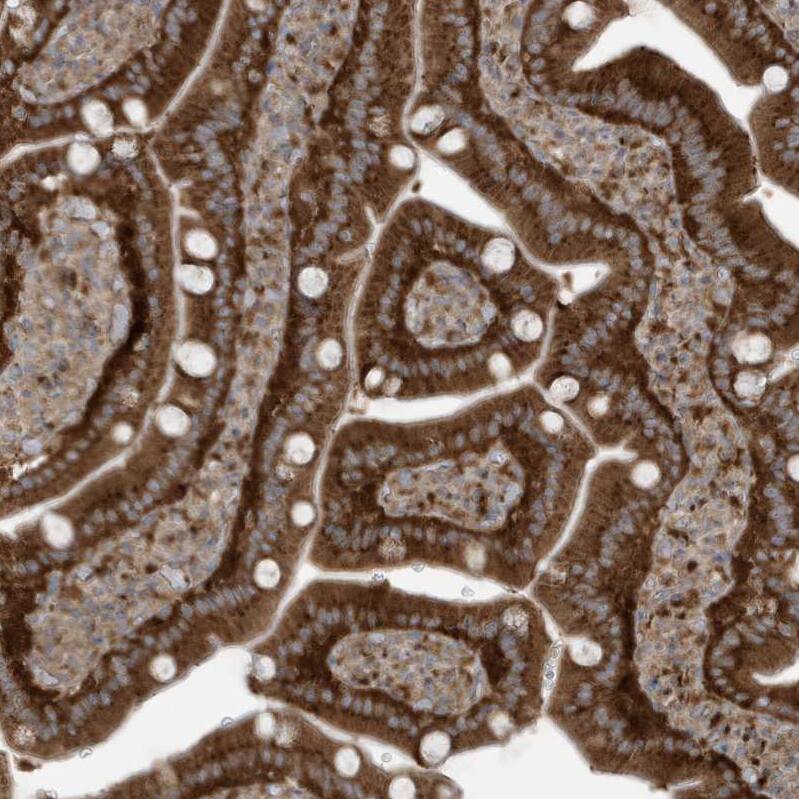 GOLGA4 Antibody - BSA Free Immunohistochemistry: GOLGA4 Antibody - BSA Free [NBP1-93719]
