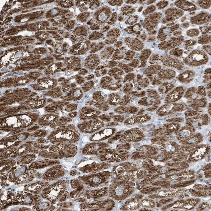 GOLGA4 Antibody - BSA Free Immunohistochemistry: GOLGA4 Antibody - BSA Free [NBP1-93719]