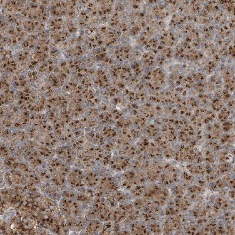 GOLGA4 Antibody - BSA Free Immunohistochemistry: GOLGA4 Antibody - BSA Free [NBP1-93719]