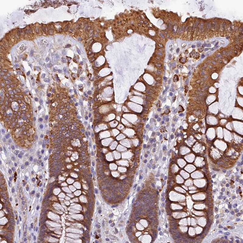 FNIP2 Antibody - BSA Free Immunohistochemistry: FNIP2 Antibody - BSA Free [NBP1-93724]