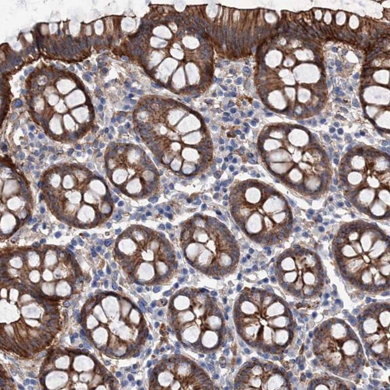 TMTC3 Antibody - BSA Free Immunohistochemistry: TMTC3 Antibody - BSA Free [NBP1-93728]