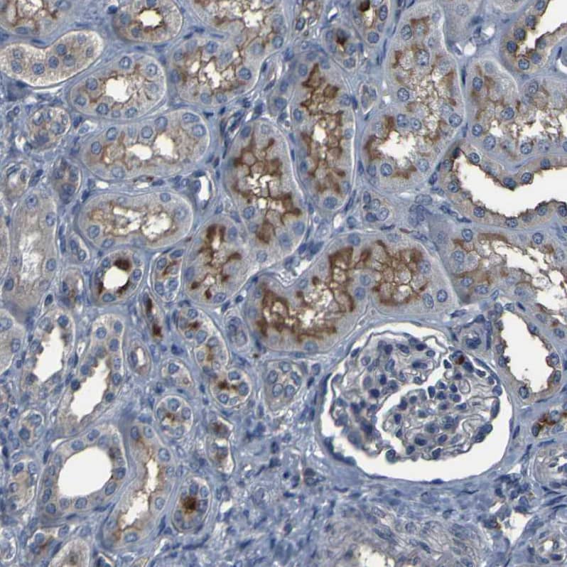 GRAMD1A Antibody - BSA Free Immunohistochemistry: GRAMD1A Antibody - BSA Free [NBP1-93729]