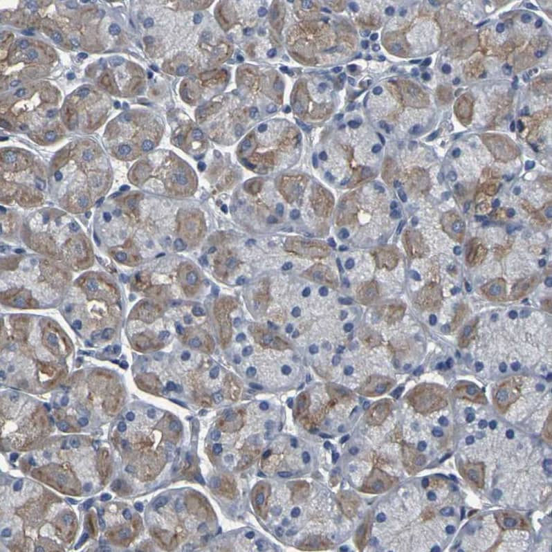 GRAMD1A Antibody - BSA Free Immunohistochemistry: GRAMD1A Antibody - BSA Free [NBP1-93729]