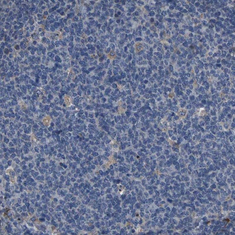 GRAMD1A Antibody - BSA Free Immunohistochemistry: GRAMD1A Antibody - BSA Free [NBP1-93729]