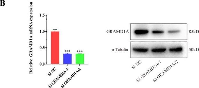 GRAMD1A Antibody - BSA Free