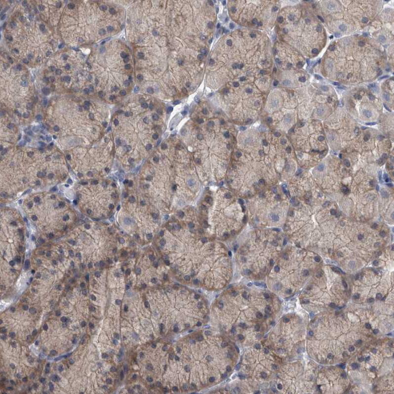 FAM83H Antibody - BSA Free Immunohistochemistry: FAM83H Antibody - BSA Free [NBP1-93737]