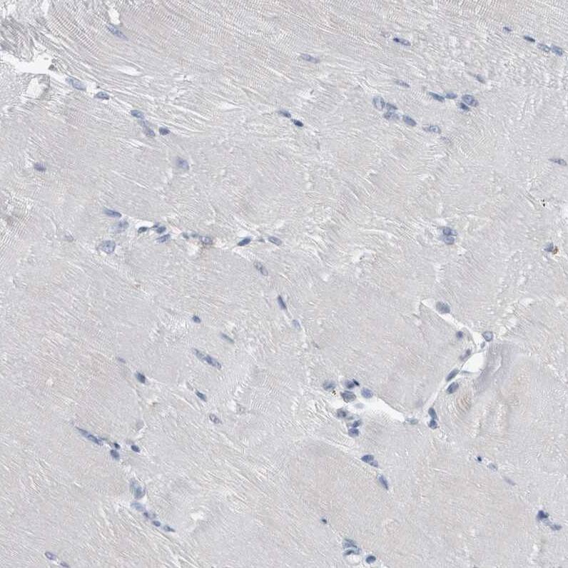 FAM83H Antibody - BSA Free Immunohistochemistry: FAM83H Antibody - BSA Free [NBP1-93737]