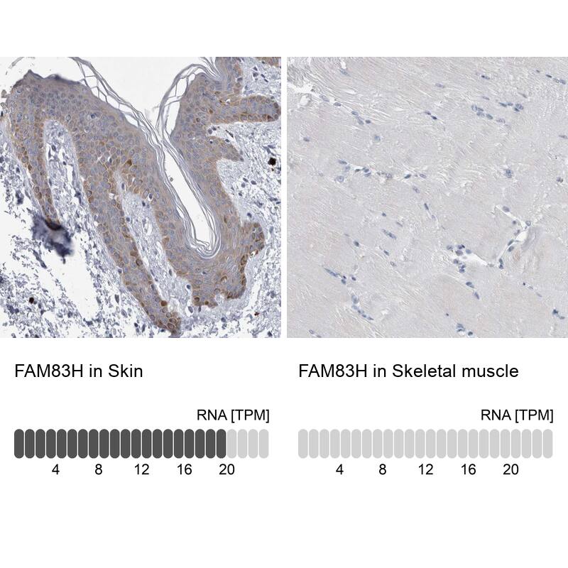 FAM83H Antibody - BSA Free Immunohistochemistry: FAM83H Antibody - BSA Free [NBP1-93737]