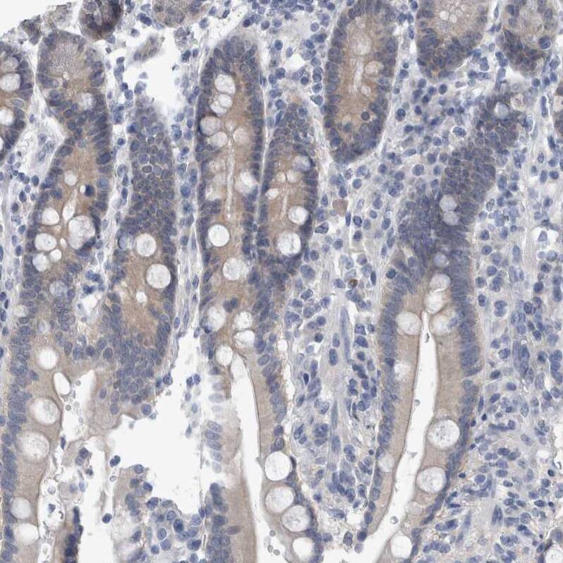 FAM83H Antibody - BSA Free Immunohistochemistry: FAM83H Antibody - BSA Free [NBP1-93737]