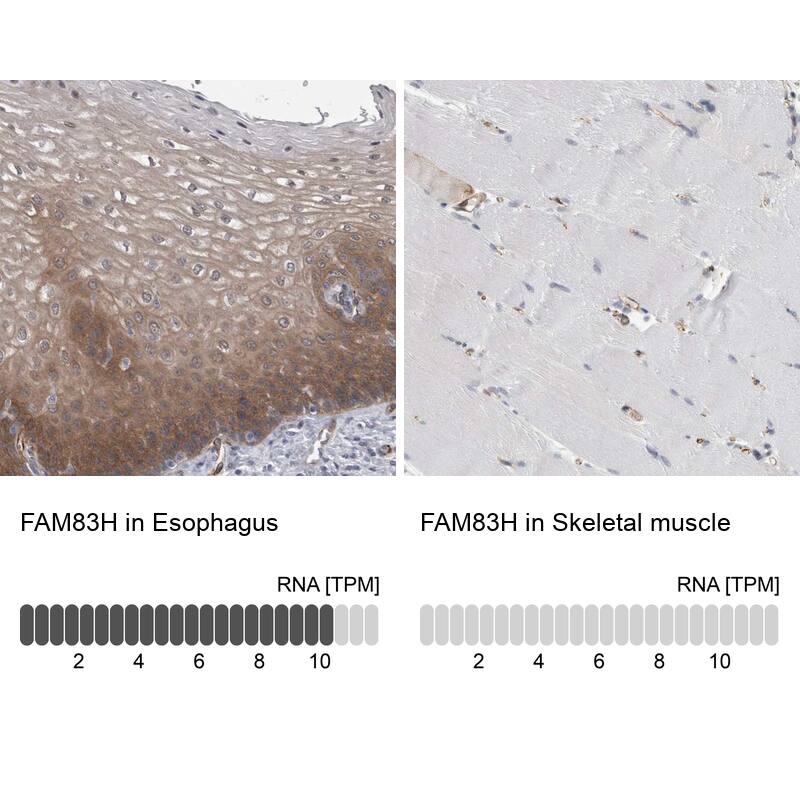 FAM83H Antibody - BSA Free Immunohistochemistry: FAM83H Antibody - BSA Free [NBP1-93738]