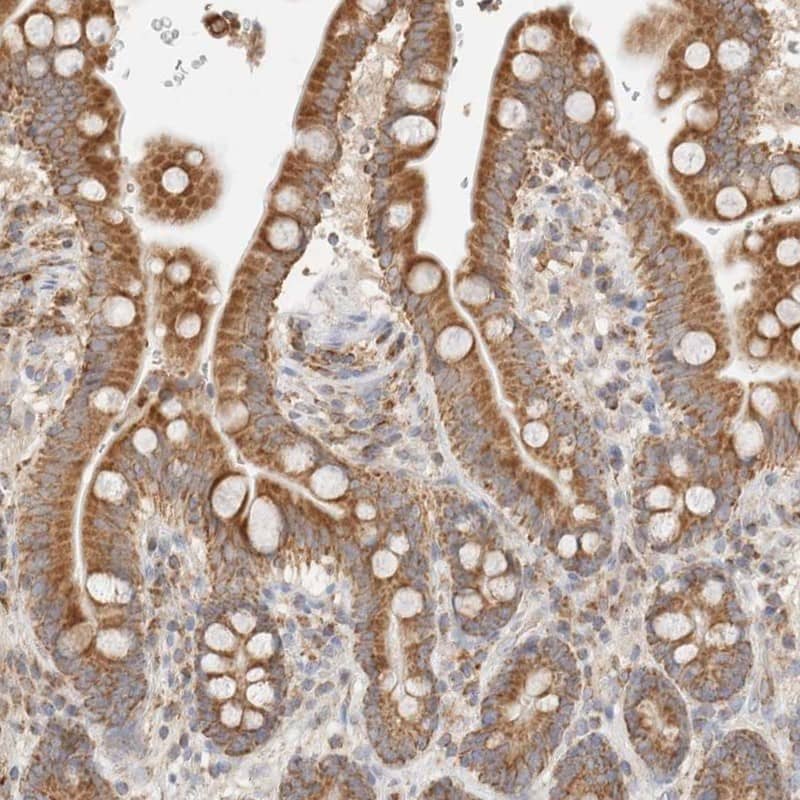 TMPPE Antibody - BSA Free Immunohistochemistry-Paraffin: TMPPE Antibody [NBP1-93749]