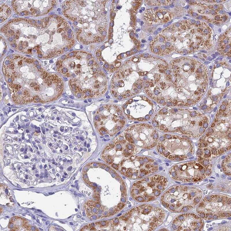 SPIN4 Antibody - BSA Free Immunohistochemistry: SPIN4 Antibody - BSA Free [NBP1-93750]