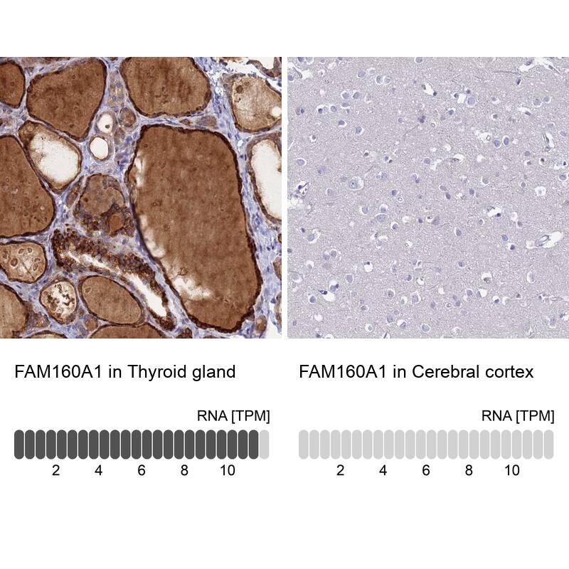 FAM160A1 Antibody - BSA Free Immunohistochemistry: FAM160A1 Antibody - BSA Free [NBP1-93760]