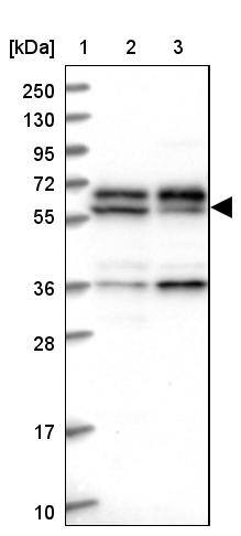 CCDC9B Antibody - BSA Free Western Blot: CCDC9B Antibody - BSA Free [NBP1-93764]