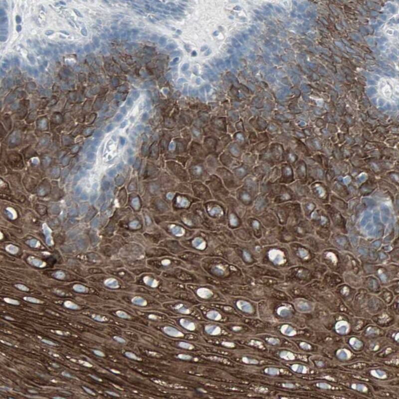 LANCL3 Antibody - BSA Free Immunohistochemistry: LANCL3 Antibody - BSA Free [NBP1-93767]