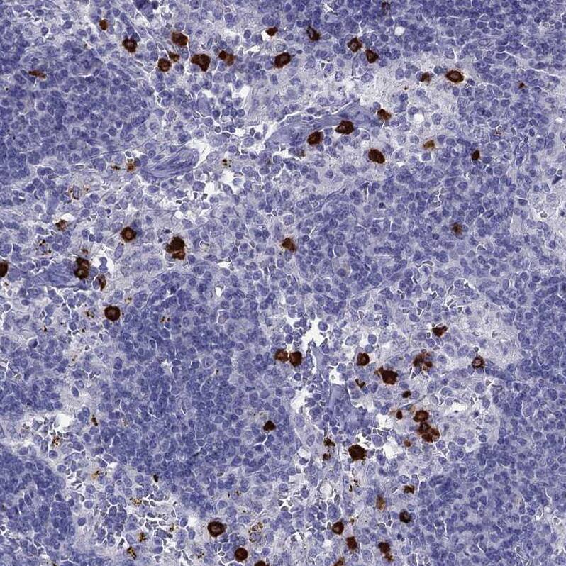 IL17REL Antibody - BSA Free Immunohistochemistry: IL17REL Antibody - BSA Free [NBP1-93769]