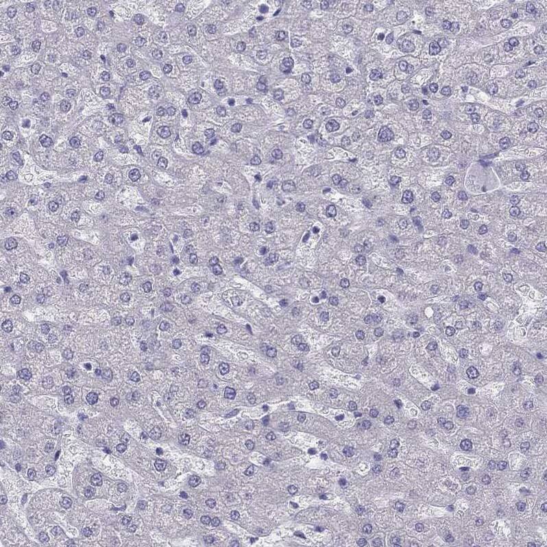IL17REL Antibody - BSA Free Immunohistochemistry: IL17REL Antibody - BSA Free [NBP1-93769]