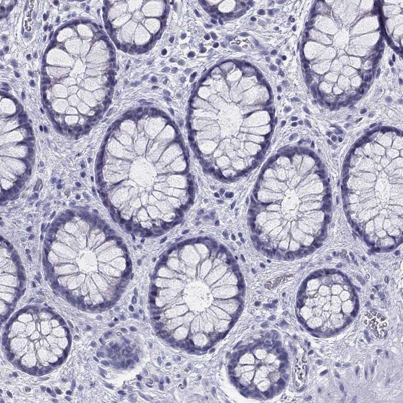 IL17REL Antibody - BSA Free Immunohistochemistry: IL17REL Antibody - BSA Free [NBP1-93769]