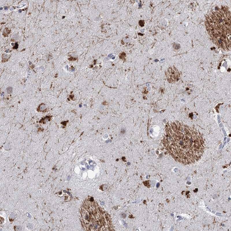 C16orf72 Antibody - BSA Free Immunohistochemistry-Paraffin: C16orf72 Antibody [NBP1-93773]