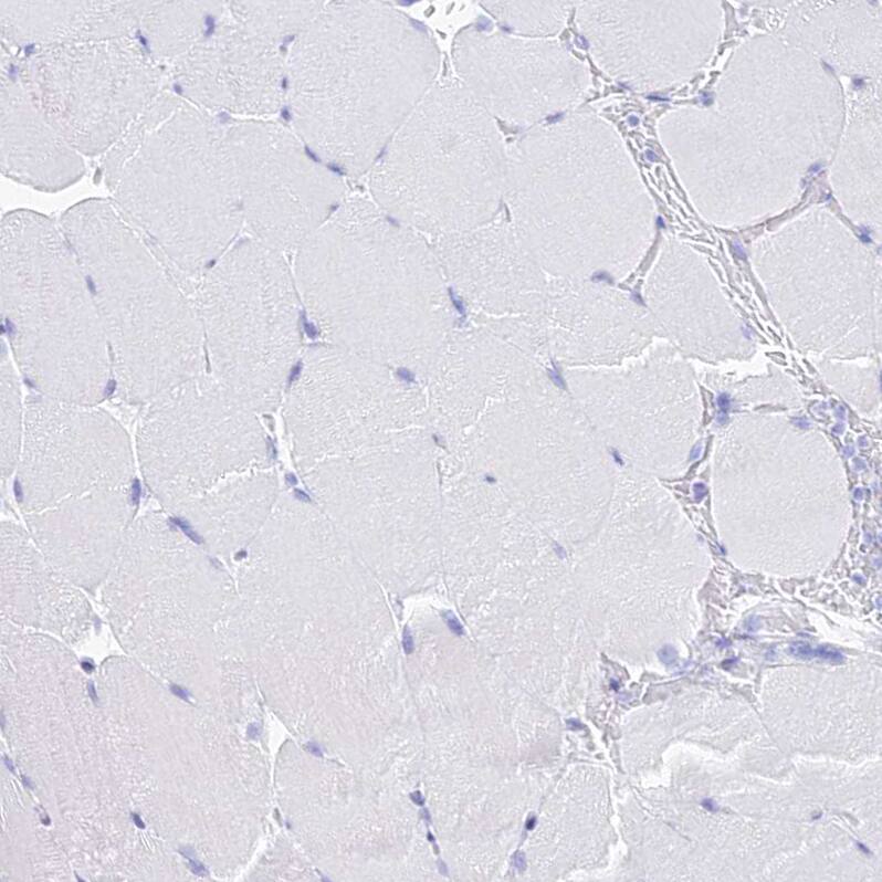 PATE4 Antibody - BSA Free Immunohistochemistry: PATE4 Antibody - BSA Free [NBP1-93774]