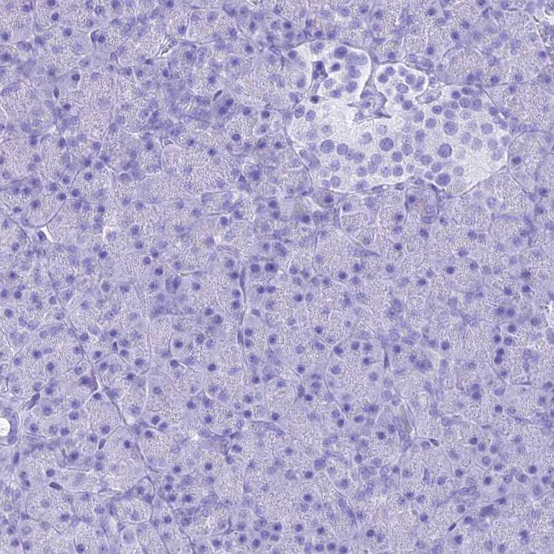 PATE4 Antibody - BSA Free Immunohistochemistry: PATE4 Antibody - BSA Free [NBP1-93774]