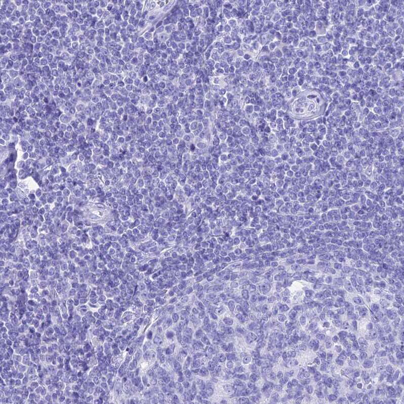 PATE4 Antibody - BSA Free Immunohistochemistry: PATE4 Antibody - BSA Free [NBP1-93774]