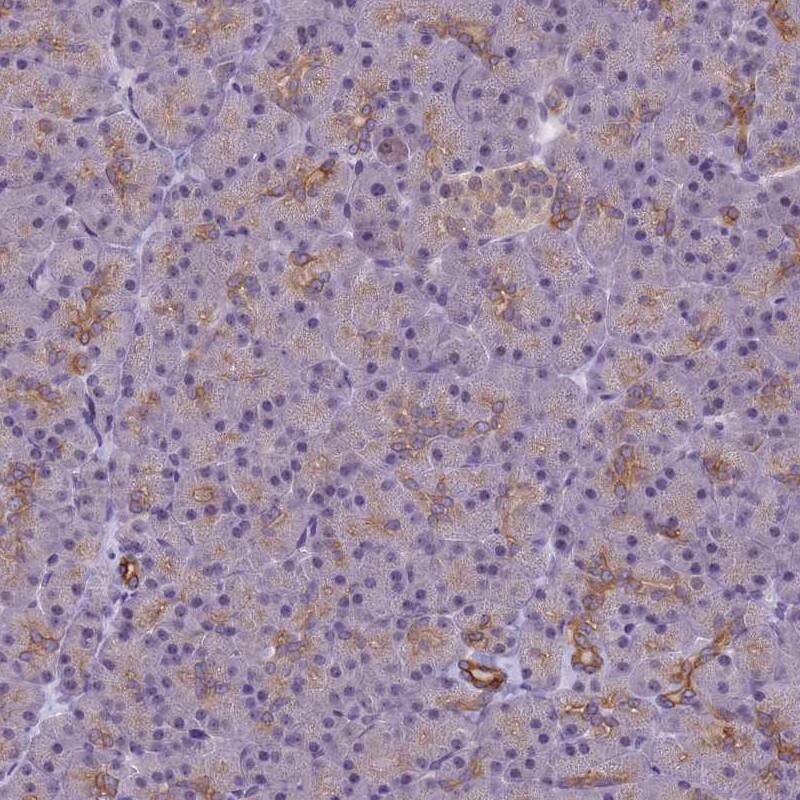 VWA3A Antibody - BSA Free Immunohistochemistry: VWA3A Antibody - BSA Free [NBP1-93776]
