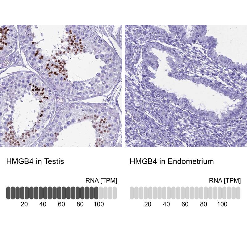 HMGB4 Antibody - BSA Free Immunohistochemistry: HMGB4 Antibody - BSA Free [NBP1-93780]