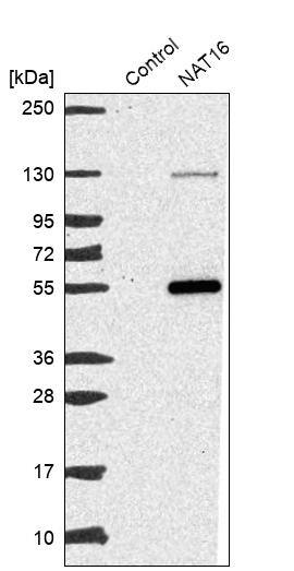 NAT16 Antibody - BSA Free Western Blot: NAT16 Antibody - BSA Free [NBP1-93791]
