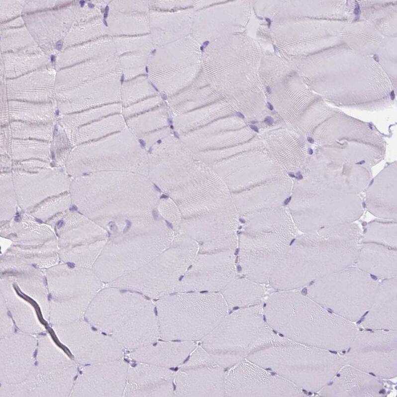 RPTN Antibody - BSA Free Immunohistochemistry-Paraffin: RPTN Antibody [NBP1-93792]