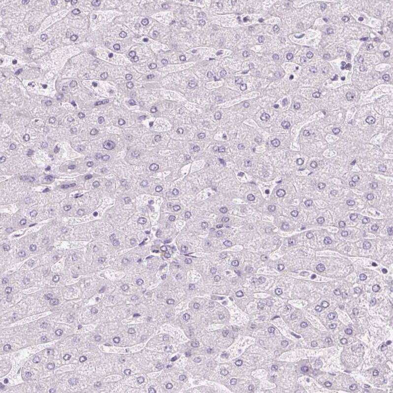 RPTN Antibody - BSA Free Immunohistochemistry-Paraffin: RPTN Antibody [NBP1-93792]