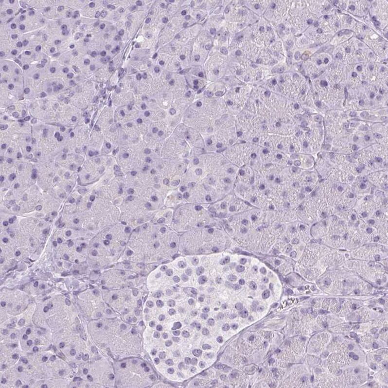 RPTN Antibody - BSA Free Immunohistochemistry-Paraffin: RPTN Antibody [NBP1-93792]