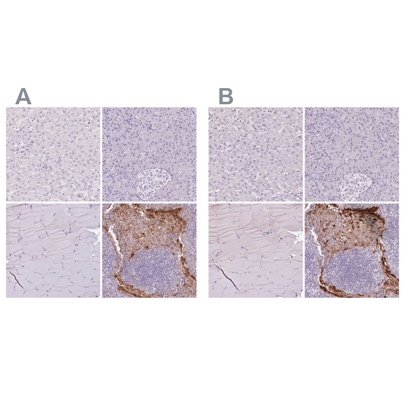 RPTN Antibody - BSA Free Immunohistochemistry: RPTN Antibody - BSA Free [NBP1-93792]