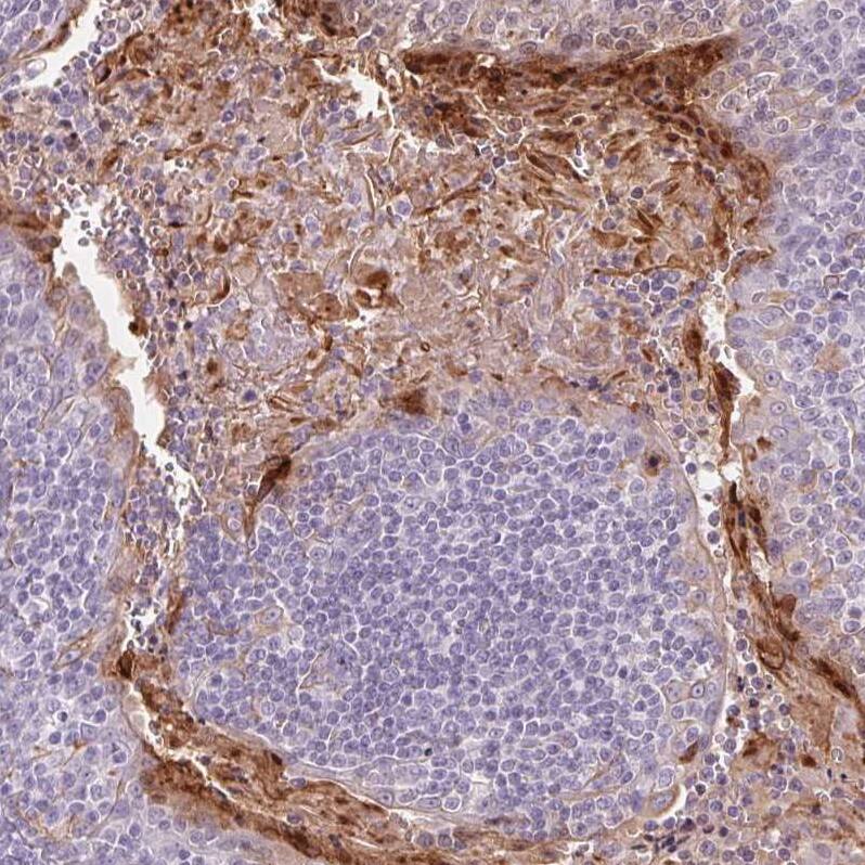 RPTN Antibody - BSA Free Immunohistochemistry: RPTN Antibody - BSA Free [NBP1-93792]